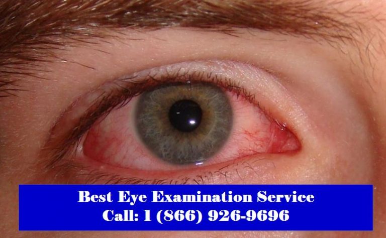 what-is-the-best-pink-eye-treatment-edmonton-vision-centre